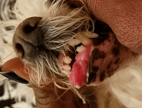 11:18:16 mouth tumor