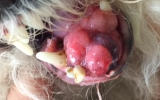 12:17:16 Mouth tumor